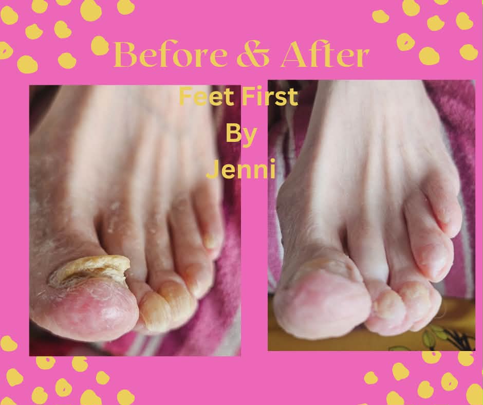 Before and after foot care