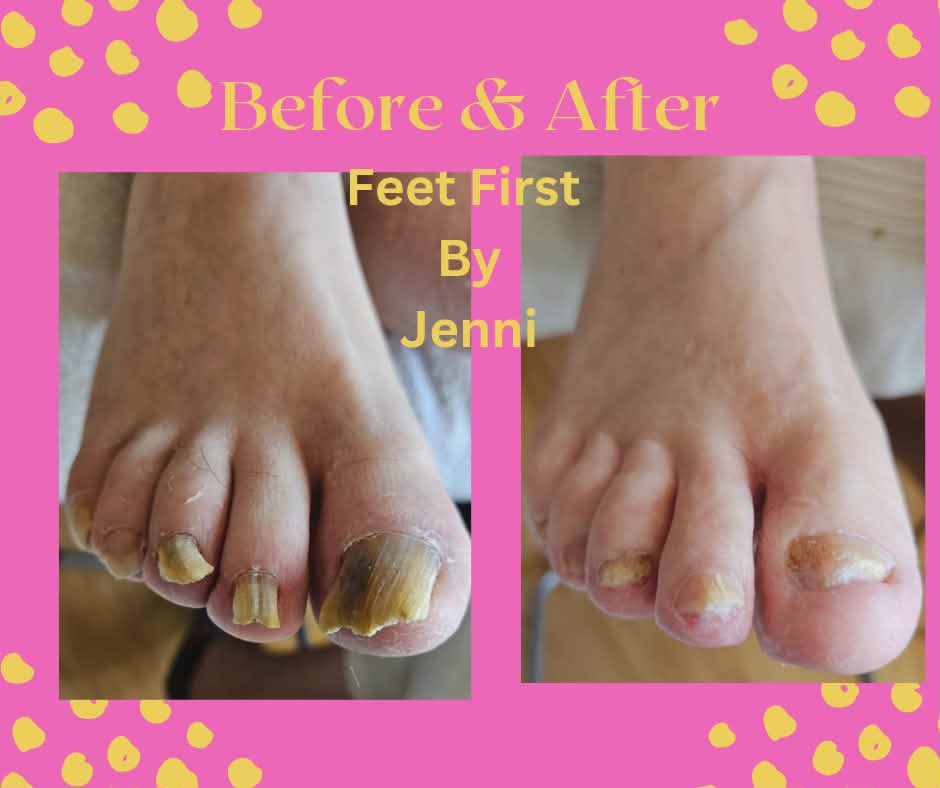 Feet First by Jenni